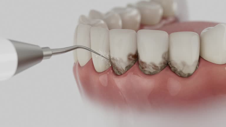 Reliable Teeth Cleaning And Checkup contractor in Allegany County County, MD by Dentist Open Now